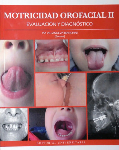 Motricidad Orofacial Ii Evaluacion-diagnostico / Villanueva