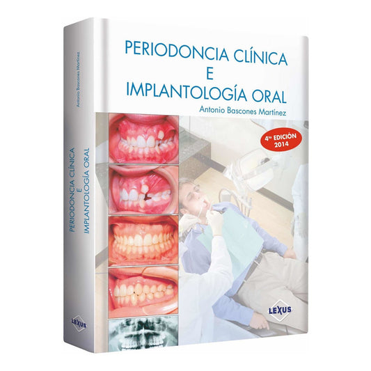 Periodoncia Clínica E Implantología Oral (tapa Dura) / Lexus
