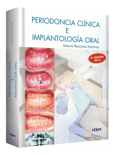 Periodoncia Clínica E Implantología Oral (tapa Dura) / Lexus