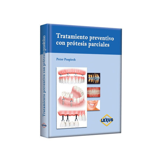 Tratamiento Preventivo Con Prótesis Parciales / Pospiech