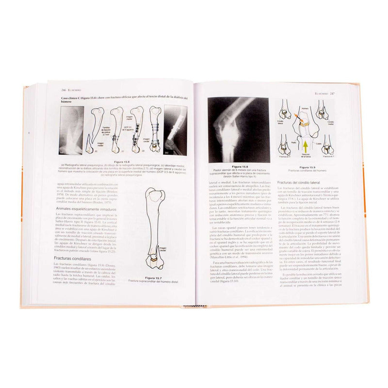 Manual De Reparación Y Tratamiento De Fracturas / Lexus