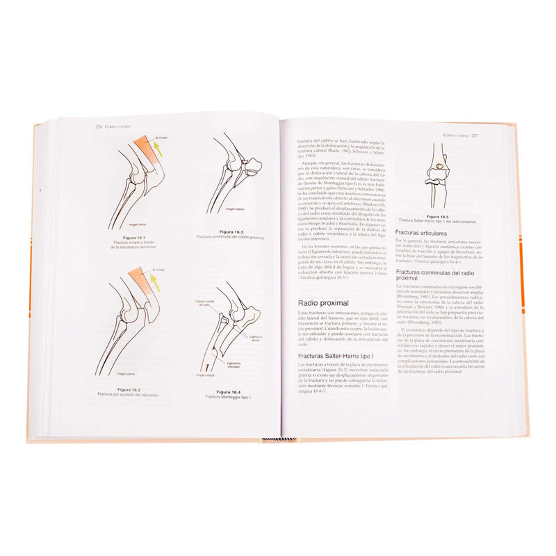 Manual De Reparación Y Tratamiento De Fracturas / Lexus
