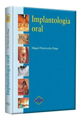 Peñarocha Implantología Oral / Lexus