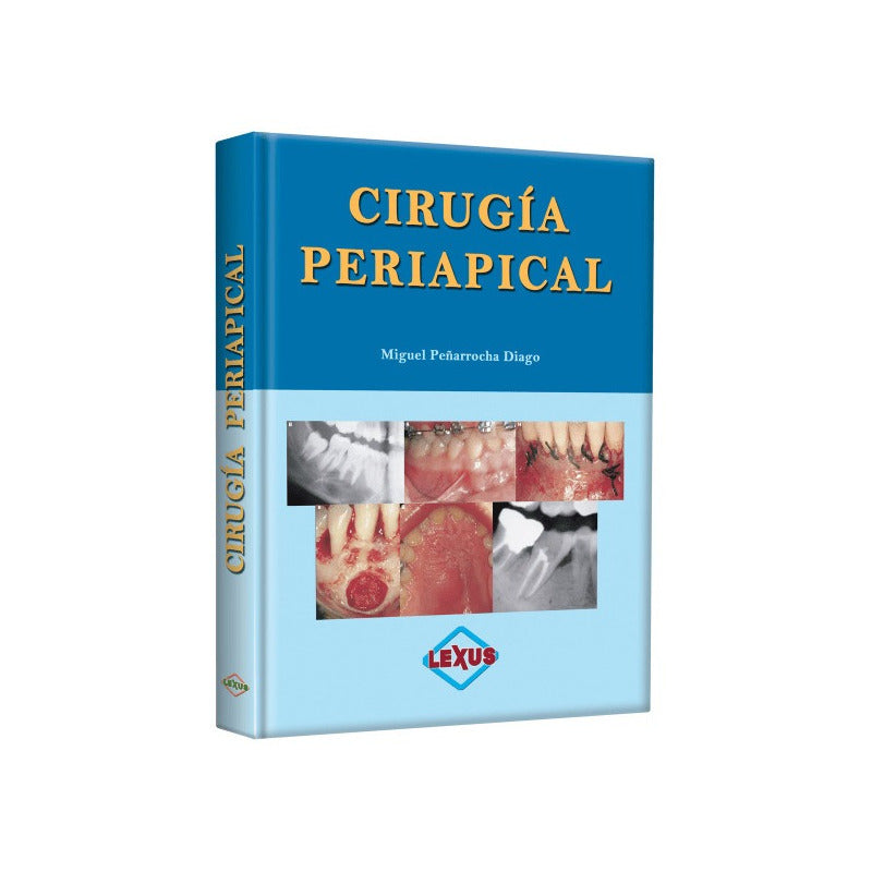 Peñarocha Cirugía Periapical / Lexus
