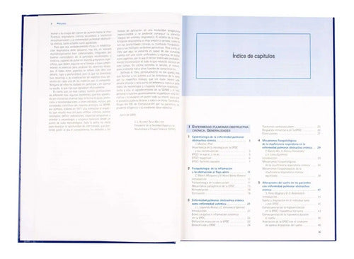 Tratado De Rehabilitación Respiratoria (tapa Dura) / Lexus